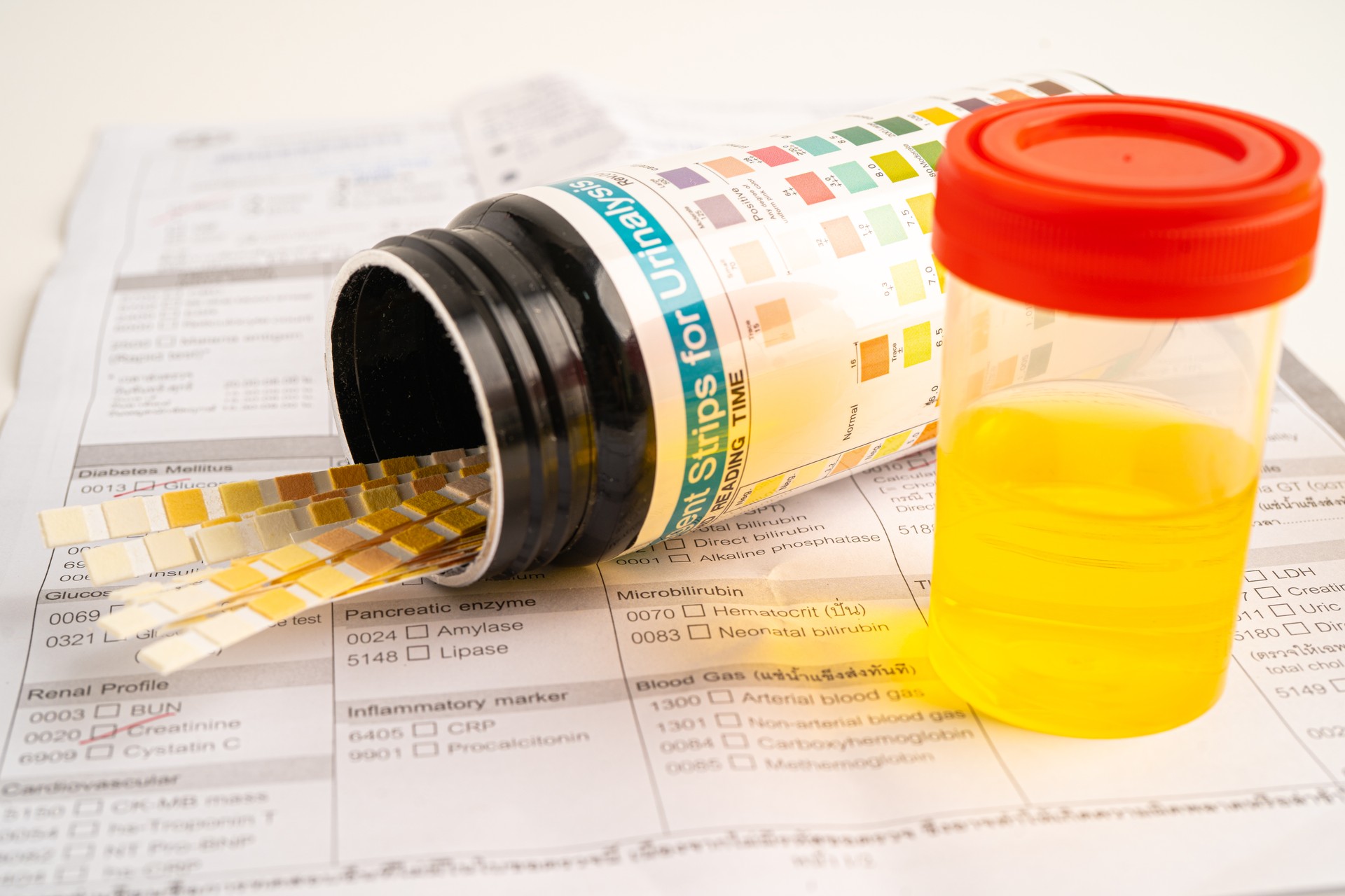 Urinalysis, urine cup with reagent strip pH paper test and comparison chart in laboratory.